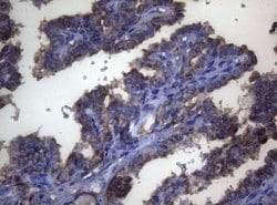 LGALS3 Monoclonal Antibody (OTI8E3), TrueMAB , OriGene 100 &mu;L; Unconjugated:Antibodies,