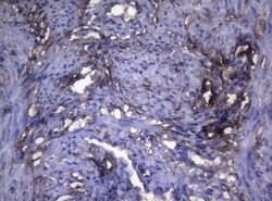 LGALS3 Monoclonal Antibody (OTI8E3), TrueMAB , OriGene 100 &mu;L; Unconjugated:Antibodies,