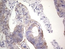 LGALS3 Mouse anti-Human, Clone: OTI21C1, lyophilized, TrueMAB 100 &mu;g;
