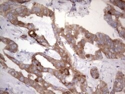LGALS3 Mouse anti-Human, Clone: OTI23D12, lyophilized, TrueMAB 100 &mu;g;