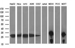 LGALS3 Monoclonal Antibody (OTI1A10), TrueMAB , OriGene 30 &mu;L; Unconjugated:Antibodies,