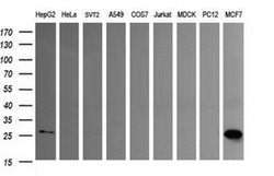 LGALS3 Monoclonal Antibody (OTI1A2), TrueMAB , OriGene 100 &mu;L; Unconjugated:Antibodies,