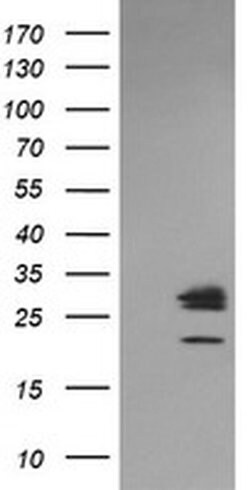 LGALS3 Monoclonal Antibody (OTI1A4), TrueMAB , OriGene 30 &mu;L; Unconjugated:Antibodies,