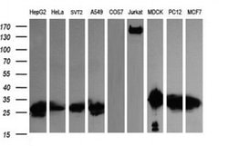 LGALS3 Monoclonal Antibody (OTI1G8), TrueMAB , OriGene 100 &mu;L; Unconjugated:Antibodies,