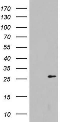 LGALS3 Mouse anti-Human, Clone: OTI1C7, lyophilized, TrueMAB 100 &mu;g;
