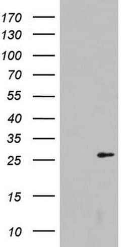 LGALS3 Monoclonal Antibody (OTI1C7), TrueMAB , OriGene 100 &mu;L; Unconjugated:Antibodies,
