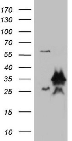 LGALS3 Mouse anti-Human, Clone: OTI2F1, lyophilized, TrueMAB 100 &mu;g;