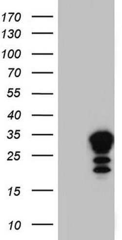 LGALS3 Monoclonal Antibody (OTI9C7), TrueMAB , OriGene 100 &mu;L; Unconjugated:Antibodies,