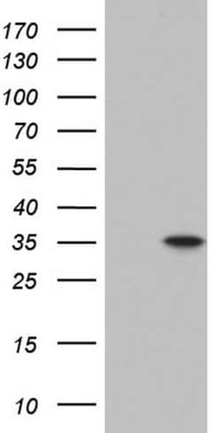 LGALS3 Monoclonal Antibody (OTI21D10), TrueMAB , OriGene 100 &mu;L; Unconjugated:Antibodies,