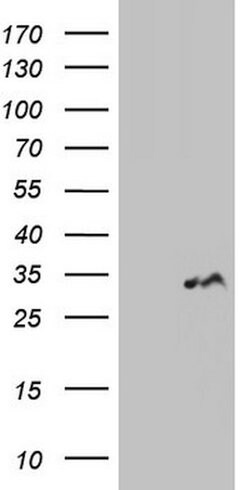 LGALS3 Mouse anti-Human, Clone: OTI21C1, lyophilized, TrueMAB 100 &mu;g;
