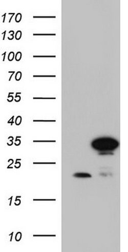 LGALS3 Mouse anti-Human, Clone: OTI23D12, lyophilized, TrueMAB 100 &mu;g;