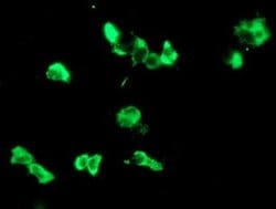 LGALS3BP Monoclonal Antibody (OTI1C2), TrueMAB , OriGene 100 &mu;L; Unconjugated:Antibodies,