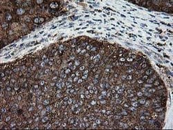 LGALS3BP Mouse anti-Human, Clone: OTI3G8, liquid, TrueMAB 100 &mu;L; Unconjugated:Antibodies,