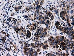 LGALS3BP Monoclonal Antibody (OTI5E3), TrueMAB , OriGene 100 &mu;L; Unconjugated:Antibodies,