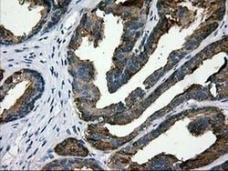 LGALS3BP Monoclonal Antibody (OTI5E3), TrueMAB , OriGene 100 &mu;L; Unconjugated:Antibodies,