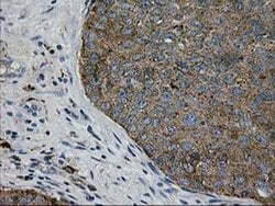 LGALS3BP Monoclonal Antibody (OTI5E3), TrueMAB , OriGene:Antibodies:Primary