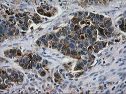 LGALS3BP Monoclonal Antibody (OTI3D6), TrueMAB , OriGene 30 &mu;L; Unconjugated:Antibodies,