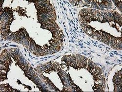 LGALS3BP Monoclonal Antibody (OTI3D6), TrueMAB , OriGene 30 &mu;L; Unconjugated:Antibodies,