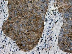 LGALS3BP Monoclonal Antibody (OTI3D6), TrueMAB , OriGene 30 &mu;L; Unconjugated:Antibodies,