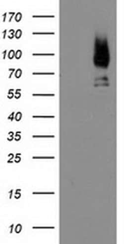 LGALS3BP Monoclonal Antibody (OTI5E3), TrueMAB , OriGene 100 &mu;L; Unconjugated:Antibodies,