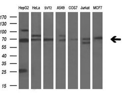 LGALS3BP Monoclonal Antibody (OTI2B1), TrueMAB , OriGene 30 &mu;L; Unconjugated:Antibodies,