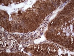LGALS9 Monoclonal Antibody (OTI21B5), TrueMAB , OriGene:Antibodies:Primary