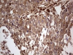 LGALS9 Monoclonal Antibody (OTI21B5), TrueMAB , OriGene:Antibodies:Primary