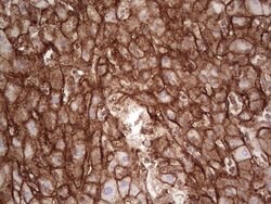 LGALS9 Mouse anti-Human, Clone: OTI19H8, TrueMAB , Origene 30 &mu;L; Unconjugated:Antibodies,