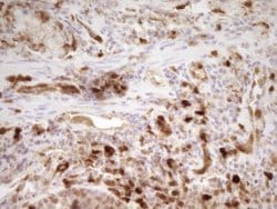 LGALS9 Mouse anti-Human, Clone: OTI2A4, liquid, TrueMAB 100 &mu;L; Unconjugated:Antibodies,