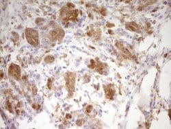 LGALS9 Mouse anti-Human, Clone: OTI2A4, liquid, TrueMAB 100 &mu;L; Unconjugated:Antibodies,