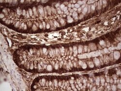 LGALS9 Mouse anti-Human, Clone: OTI1D12, lyophilized, TrueMAB 100 &mu;g | Buy Online | Origene Technologies | Fisher Scientific