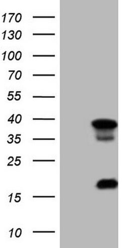 LGALS9 Monoclonal Antibody (OTI1G3), TrueMAB , OriGene:Antibodies:Primary