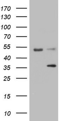 LGALS9 Monoclonal Antibody (OTI21B5), TrueMAB , OriGene 100 &mu;L; Unconjugated:Antibodies,