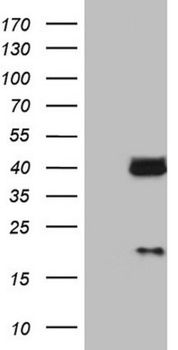 LGALS9 Mouse anti-Human, Clone: OTI19F7, lyophilized, TrueMAB 100 &mu;g;