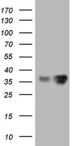 LGALS9 Mouse anti-Human, Clone: OTI19H8, TrueMAB , Origene 30 &mu;L; Unconjugated:Antibodies,