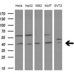 LGALS9 Monoclonal Antibody (OTI2E10), TrueMAB , OriGene 100 &mu;L; Unconjugated:Antibodies,
