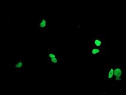 LHX1 Mouse anti-Human, Clone: OTI1A5, lyophilized, TrueMAB 100 &mu;g; Unconjugated:Antibodies,