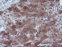 LHX1 Mouse anti-Human, Clone: OTI3A9, lyophilized, TrueMAB 100 &mu;g; Unconjugated:Antibodies,