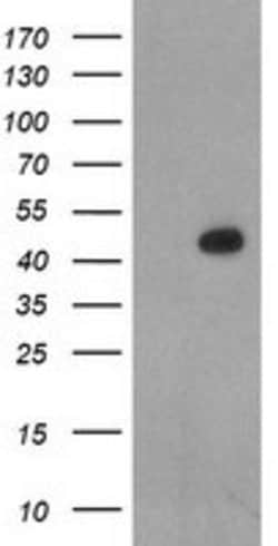 LHX1 Mouse anti-Human, Clone: OTI1A5, lyophilized, TrueMAB 100 &mu;g; Unconjugated:Antibodies,