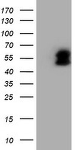 LHX1 Monoclonal Antibody (OTI2B4), TrueMAB , OriGene 100 &mu;L; Unconjugated:Antibodies,