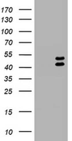 LHX1 Monoclonal Antibody (OTI1D5), TrueMAB , OriGene 30 &mu;L; Unconjugated:Antibodies,