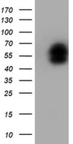 LHX1 Monoclonal Antibody (OTI3A9), TrueMAB , OriGene 30 &mu;L; Unconjugated:Antibodies,