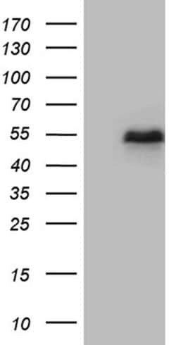 LHX2 Monoclonal Antibody (OTI3D3), TrueMAB , OriGene:Antibodies:Primary