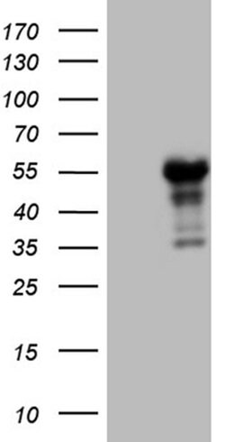 LHX4 Monoclonal Antibody (OTI4E11), TrueMAB , OriGene:Antibodies:Primary