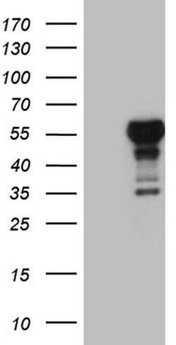 LHX4 Monoclonal Antibody (OTI1C7), TrueMAB , OriGene 100 &mu;L; Unconjugated:Antibodies,