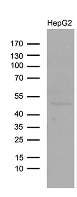 LHX4 Monoclonal Antibody (OTI6H3), TrueMAB , OriGene:Antibodies:Primary