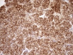 LIMA1 Mouse anti-Human, Clone: OTI1A3, TrueMAB , Origene 30 &mu;L; Unconjugated:Antibodies,