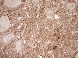LIMA1 Mouse anti-Human, Clone: OTI1A3, TrueMAB , Origene 30 &mu;L; Unconjugated:Antibodies,
