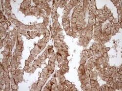 LIMA1 Mouse anti-Human, Clone: OTI1A3, TrueMAB , Origene 30 &mu;L; Unconjugated:Antibodies,