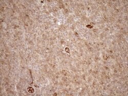 LIMA1 Mouse anti-Human, Clone: OTI1A3, TrueMAB , Origene 30 &mu;L; Unconjugated:Antibodies,